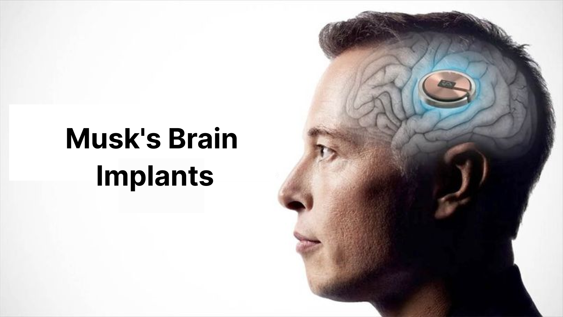 Musk's Brain Implants